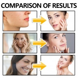 EELHOE Copper Peptide Serum, Fade Out Fine Lines Moisturize Skin Firming Bright Spots And Delicate Pores