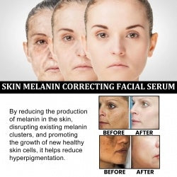 Melanin Repairing Facial