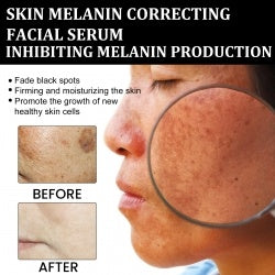 Melanin Repairing Facial